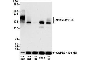 Western Blotting (WB) image for anti-Neural Cell Adhesion Molecule 1 (NCAM1) (AA 20-318) antibody (ABIN7449431)