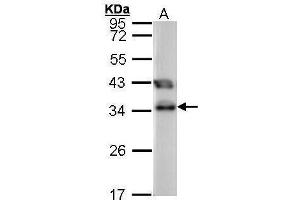 WB Image Sample (30 ug of whole cell lysate) A: 293T 12% SDS PAGE antibody diluted at 1:1000 (TTC1 anticorps)