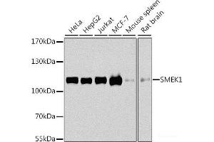 Western blot analysis of extracts of various cell lines using SMEK1 Polyclonal Antibody at dilution of 1:1000. (SMEK1 anticorps)