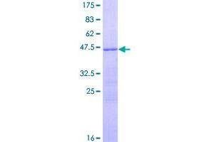 Image no. 1 for R-Spondin 2 (RSPO2) (AA 1-176) protein (GST tag) (ABIN1318936)