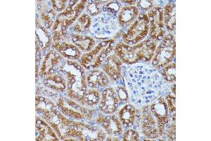 Immunohistochemistry of paraffin-embedded mouse kidney using DDX6 antibody (ABIN7266704) at dilution of 1:100 (40x lens). (DDX6 anticorps  (C-Term))