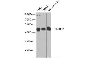 Western blot analysis of extracts of various cell lines using TARBP2 Polyclonal Antibody at dilution of 1:1000. (TARBP2 anticorps)