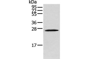 Western blot analysis of Human fetal brain tissue using TPPP Polyclonal Antibody at dilution of 1:250 (Tppp anticorps)
