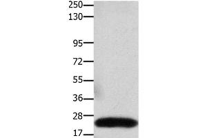 Western Blot analysis of Human colon cancer tissue using Claudin 3 Polyclonal Antibody at dilution of 1:550
