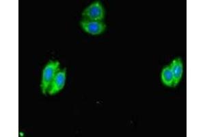 Immunofluorescent analysis of HepG2 cells using ABIN7169234 at dilution of 1:100 and Alexa Fluor 488-congugated AffiniPure Goat Anti-Rabbit IgG(H+L) (WNK4 anticorps  (AA 828-1106))