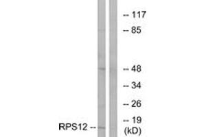 Western blot analysis of extracts from COLO cells, using RPS12 Antibody. (RPS12 anticorps  (AA 83-132))