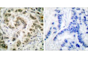 Peptide - +Immunohistochemical analysis of paraffin-embedded human lung carcinoma tissue usingantibody (#C0178).
