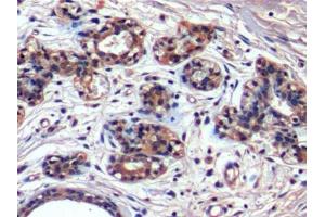 anti-Hepatitis A Virus Cellular Receptor 2 (TIM 3) (AA 22-202) antibody