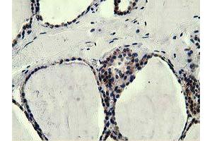 Immunohistochemical staining of paraffin-embedded Human liver tissue using anti-L1CAM mouse monoclonal antibody. (L1CAM anticorps)