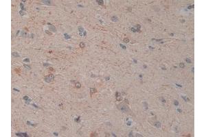 Detection of IL12A in Human Cerebrum Tissue using Monoclonal Antibody to Interleukin 12A (IL12A) (IL12A anticorps  (AA 23-219))