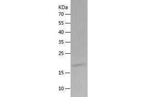 Western Blotting (WB) image for Leukemia Inhibitory Factor (LIF) (AA 23-202) (Active) protein (His tag) (ABIN7123756)