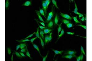 Immunofluorescence staining of Hela cells with ABIN7170983 at 1:250, counter-stained with DAPI. (SOD2 anticorps  (AA 64-175))