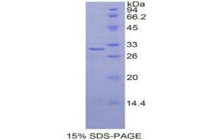 SDS-PAGE analysis of Human IGF2BP2 Protein. (IGF2BP2 Protéine)