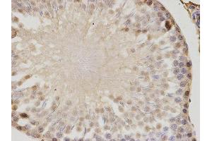 Immunohistochemistry (IHC) image for anti-Proteasome (Prosome, Macropain) Activator Subunit 1 (PA28 Alpha) (PSME1) antibody (ABIN1876546) (PSME1 anticorps)