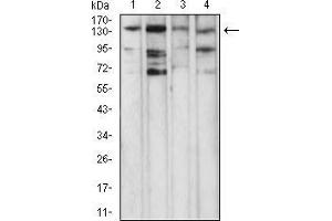 Western blot analysis using PLCG1 mouse mAb against NIH/3T3 (1), Jurkat (2), A431 (3), and Hela (4) cell lysate.