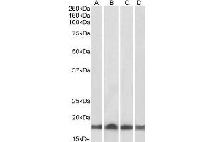 Western Blotting (WB) image for anti-Ubiquitin-Conjugating Enzyme E2L 3 (UBE2L3) antibody (ABIN5894613) (UBE2L3 anticorps)