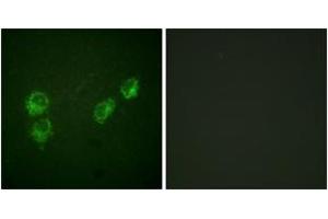 Immunofluorescence analysis of HuvEc cells, using PLB (Phospho-Ser16+Thr17) Antibody. (Phospholamban anticorps  (pSer16))