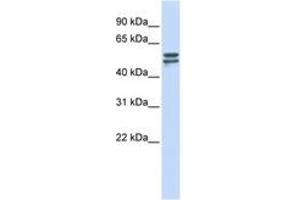 Image no. 1 for anti-Glucose-6-Phosphate Dehydrogenase (G6PD) (AA 180-229) antibody (ABIN6744275) (Glucose-6-Phosphate Dehydrogenase anticorps  (AA 180-229))