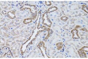 Immunohistochemistry of paraffin-embedded Rat kidney using ITGAV Polyclonal Antibody at dilution of 1:50 (40x lens).