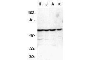 Western blot analysis of caspase-10 in HeLa (H), Jurkat (J), A431 (A), K562 (K) whole cell lysates with AP30189PU-N Caspase-10 antibody at 1 μg/ml.