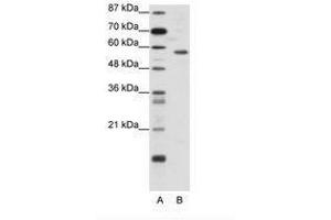 Image no. 1 for anti-YY1 Transcription Factor (YY1) (N-Term) antibody (ABIN6736135) (YY1 anticorps  (N-Term))