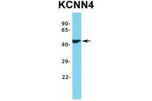 Host:  Rabbit  Target Name:  KCNN4  Sample Type:  MCF7  Antibody Dilution:  1.