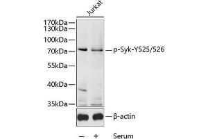 Western blot analysis of extracts of Jurkat cells, using Phospho-Syk-Y525/526 antibody (ABIN6135327, ABIN6136270, ABIN6136271 and ABIN6225570) at 1:1000 dilution. (SYK anticorps  (pTyr525, pTyr526))