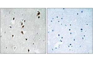 Immunohistochemistry analysis of paraffin-embedded human brain, using Mnk1 (Phospho-Thr385) Antibody. (MKNK1 anticorps  (pThr385))
