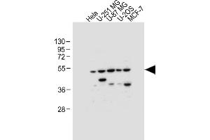 All lanes : Anti-DFNA5 Antibody (N-term) at 1:1000 dilution Lane 1: Hela whole cell lysate Lane 2: U-251 MG whole cell lysate Lane 3: U-87 MG whole cell lysate Lane 4: U-2OS whole cell lysate Lane 5: MCF-7 whole cell lysate Lysates/proteins at 20 μg per lane. (DFNA5 anticorps  (N-Term))