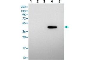 Western blot analysis of Lane 1: RT-4, Lane 2: U-251 MG, Lane 3: Human Plasma, Lane 4: Liver, Lane 5: Tonsil with PRDM12 polyclonal antibody  at 1:250-1:500 dilution. (PRDM12 anticorps)