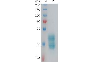 Coagulation Factor II (Thrombin) Receptor-Like 3 (F2RL3) (AA 48-78) protein (Fc Tag)