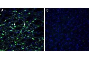 Expression of Histamine H1 Receptor in mouse substantia nigraImmunohistochemical staining of perfusion-fixed frozen mouse brain sections with Anti-Histamine H1 Receptor/HRH1 Antibody (extracellular) (ABIN7043269, ABIN7044512 and ABIN7044513), (1:300), followed by goat anti-rabbit-AlexaFluor-488. (Histamine Receptor H1 (HRH1) Peptide)