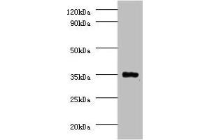 Western blot All lanes: Serine/threonine-protein phosphatase 2A catalytic subunit beta isoform Antibody at 2 μg/mL + EC109 whole cell lysate Secondary Goat polyclonal to rabbit IgG at 1/15000 dilution Predicted band size: 34 kDa Observed band size: 34 kDa (PPP2CB anticorps  (Catalytic Subunit beta))