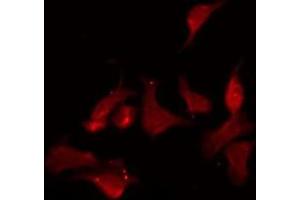 ABIN6275249 staining HuvEc by IF/ICC.