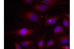 Immunofluorescence staining of methanol-fixed HeLa cells using NF-kappa,B p100(phospho-Ser870) antibody.