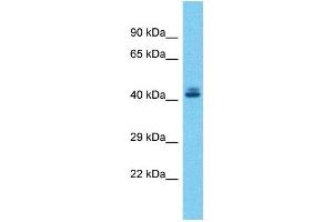 Host:  Rabbit  Target Name:  ZSCAN5A  Sample Type:  Liver tumor lysates  Antibody Dilution:  1. (ZSCAN5A anticorps  (C-Term))