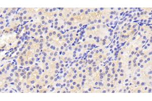 Detection of TFR in Porcine Kidney Tissue using Polyclonal Antibody to Transferrin Receptor (TFR) (Transferrin Receptor anticorps  (AA 578-765))