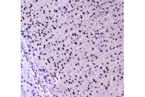 IHC testing of FFPE mouse brain tissue with RUNX1T1 antibody at 1ug/ml. (RUNX1T1 anticorps)