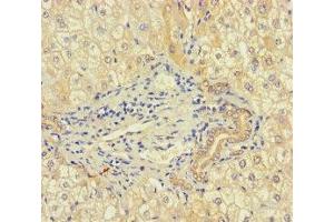 Immunohistochemistry of paraffin-embedded human liver tissue using ABIN7168083 at dilution of 1:100 (RIBC1 anticorps  (AA 1-200))