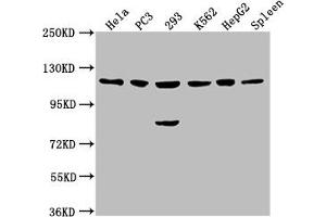 Western Blot Positive WB detected in: Hela whole cell lysate, PC3 whole cell lysate, 293 whole cell lysate, K562 whole cell lysate, HepG2 whole cell lysate, Rat spleen tissue All lanes: CDKL5 antibody at 1:2000 Secondary Goat polyclonal to rabbit IgG at 1/50000 dilution Predicted band size: 116, 108 kDa Observed band size: 116 kDa (CDKL5 anticorps  (AA 790-921))