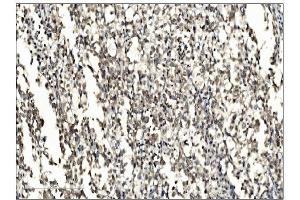 IHC analysis of SUMO2/3 using anti-SUMO2/3 antibody (ABIN7600856). (SUMO2/3 anticorps  (AA 24-72))