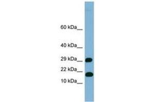 Image no. 1 for anti-TRAPPC2L (N-Term) antibody (ABIN6741901)