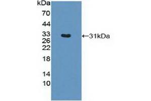 Detection of Recombinant MHCDRb1, Mouse using Polyclonal Antibody to HLA Class II Histocompatibility Antigen, DRB1 Beta Chain (HLA-DRB1) (HLA-DRB1 anticorps  (AA 27-264))