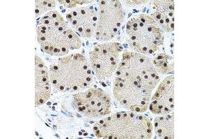 Immunohistochemistry of paraffin-embedded human stomach using EIF4G2 antibody.