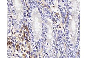 Immunohistochemistry analysis of paraffin-embedded rat colon using c-Kit Polyclonal Antibody at dilution of 1:200. (KIT anticorps)