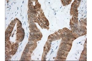 Immunohistochemical staining of paraffin-embedded Human liver tissue using anti-ACAT2 mouse monoclonal antibody. (ACAT2 anticorps)