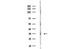 Western blot analysis of lysates from HUVEC cells(LPS,4h treatment), using SIR Antibody at 1/1000 dilution.