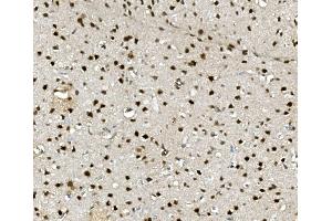 IHC analysis of NOVA2 using anti-NOVA2 antibody (ABIN7599078). (NOVA2 anticorps  (AA 1-205))