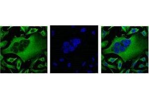 IF analysis of Hela with β-Tubulin Monoclonal Antibody(Left) and DAPI (Right) diluted at 1:100. (TUBB3 anticorps)