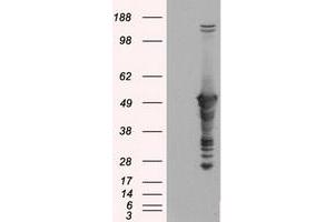 Image no. 1 for anti-Glial Fibrillary Acidic Protein (GFAP) antibody (ABIN1498437) (GFAP anticorps)